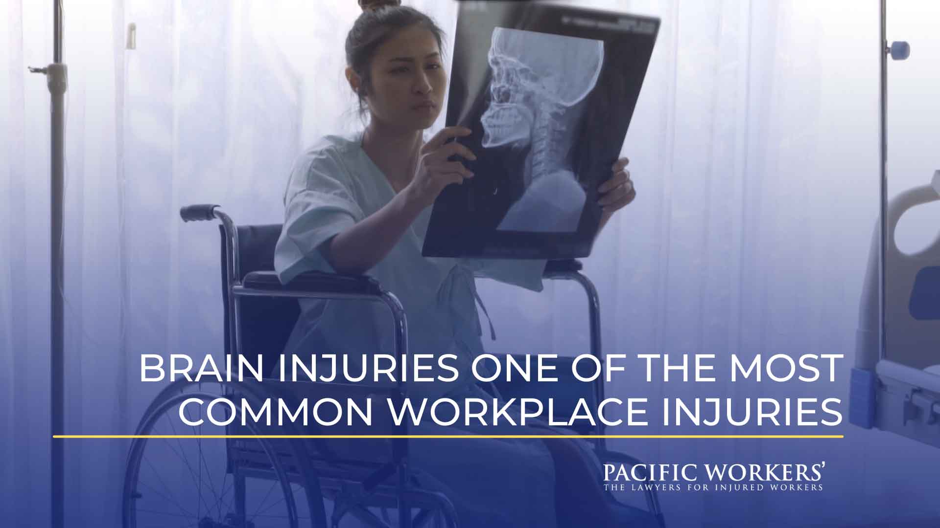 Brain Injuries One of the Most Common Workplace Injuries